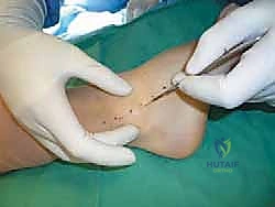 فحص عدم الاستقرار السريري