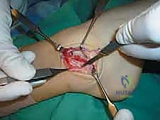 استكشاف الأنسجة الرخوة