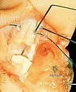 Clinical Image