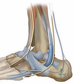 تشخيص إصابات الكاحل باستخدام أحدث التقنيات