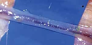 صورة توضيحية توضح تقنيات التشخيص المتقدمة لتقييم تدفق الدم في اليد قبل الجراحة.