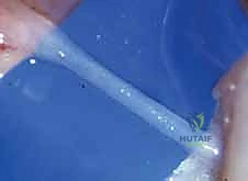 صورة توضيحية لـ إعادة توعية اليد: دليل شامل لعلاج متلازمة رينود والانسدادات الوعائية في صنعاء مع الأستاذ الدكتور محمد هطيف