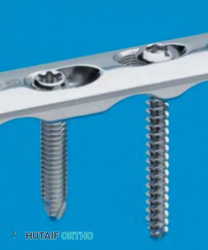 Operative Management of Tibial Fractures: Intramedullary Nailing and Locking Plate Fixation