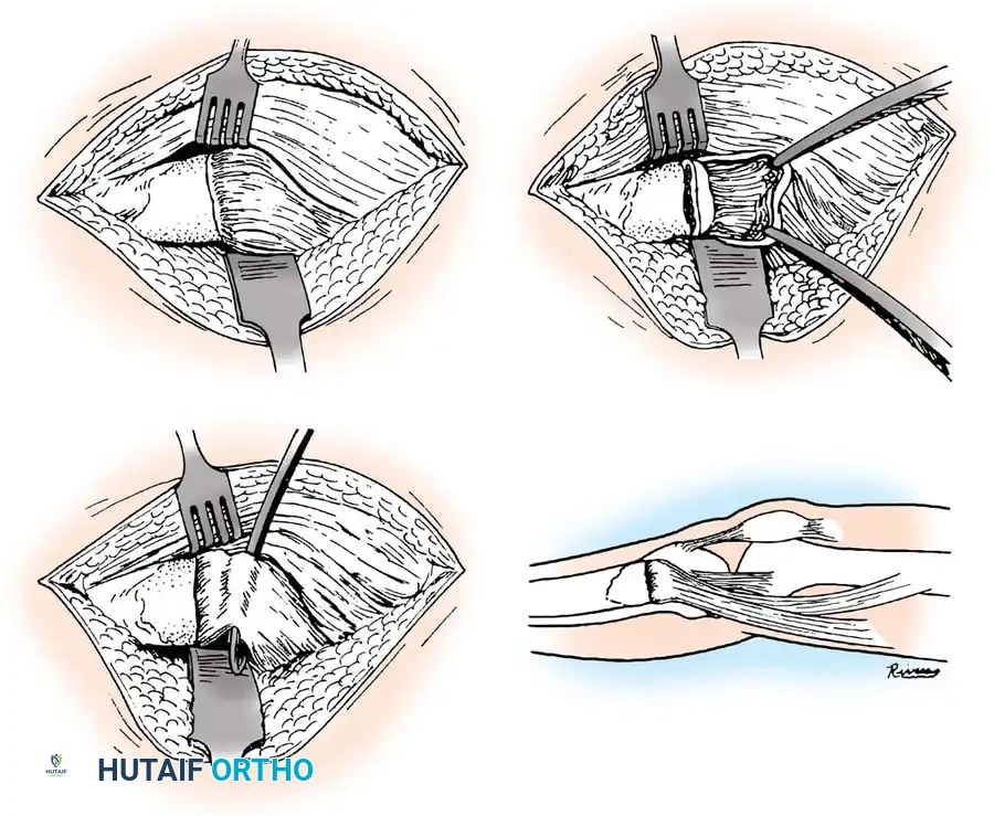 Hutaifortho's Orthopaedic Diagram