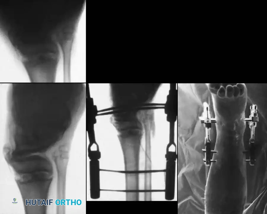 Hutaifortho's Orthopaedic Diagram