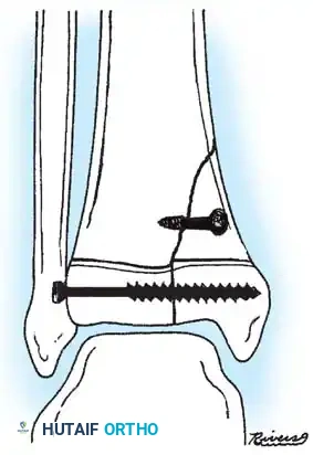 Hutaifortho's Orthopaedic Diagram