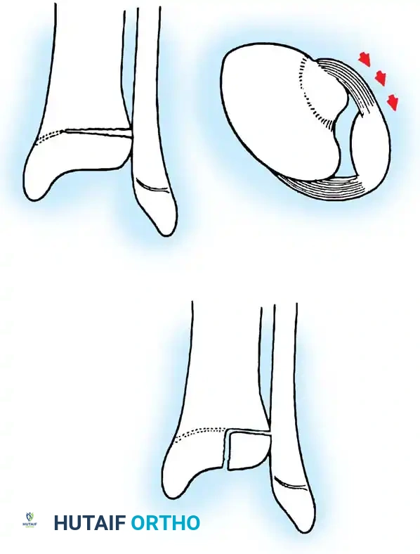Hutaifortho's Orthopaedic Diagram