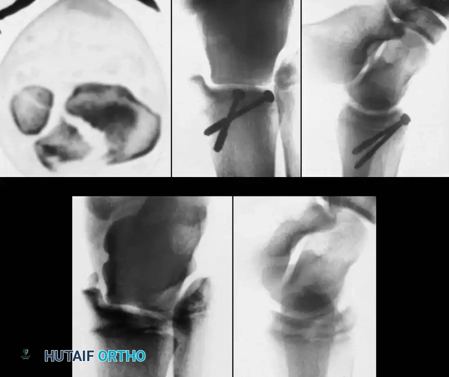 Hutaifortho's Orthopaedic Diagram