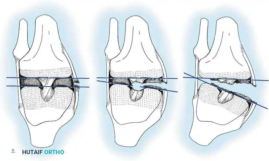 Hutaifortho's Orthopaedic Diagram