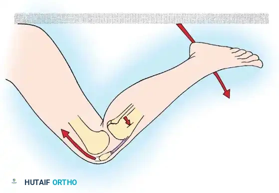 Hutaifortho's Orthopaedic Diagram