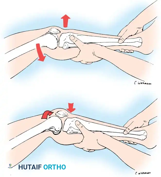 Hutaifortho's Orthopaedic Diagram