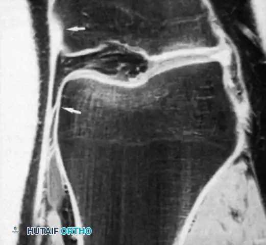 Hutaifortho's Orthopaedic Diagram