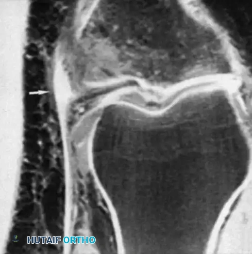 Hutaifortho's Orthopaedic Diagram