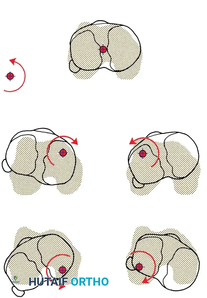 Hutaifortho's Orthopaedic Diagram