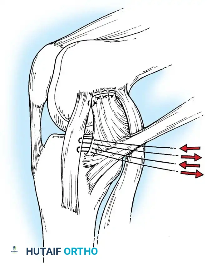 Hutaifortho's Orthopaedic Diagram