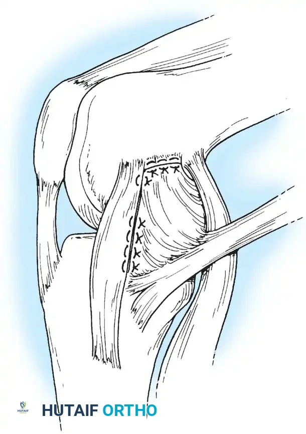 Hutaifortho's Orthopaedic Diagram