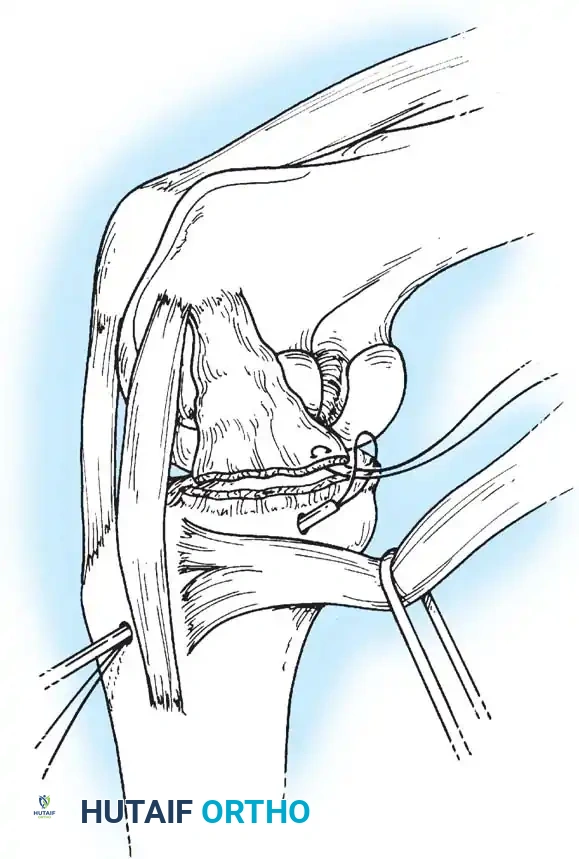 Hutaifortho's Orthopaedic Diagram