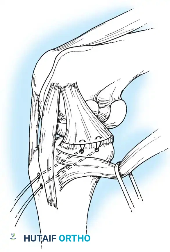 Hutaifortho's Orthopaedic Diagram
