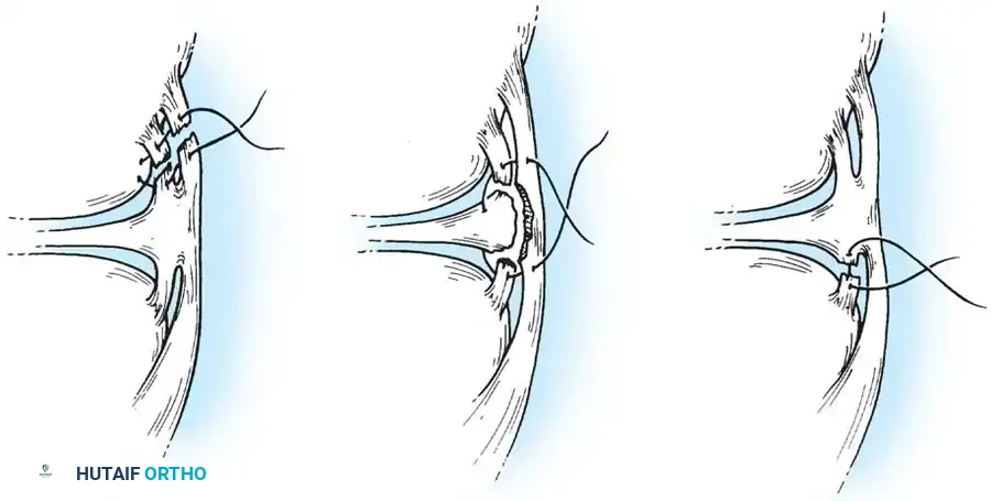 Hutaifortho's Orthopaedic Diagram