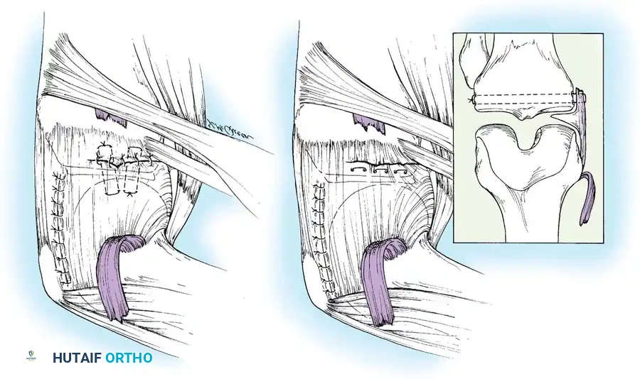 Hutaifortho's Orthopaedic Diagram