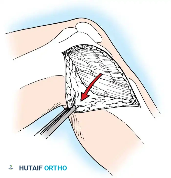 Hutaifortho's Orthopaedic Diagram