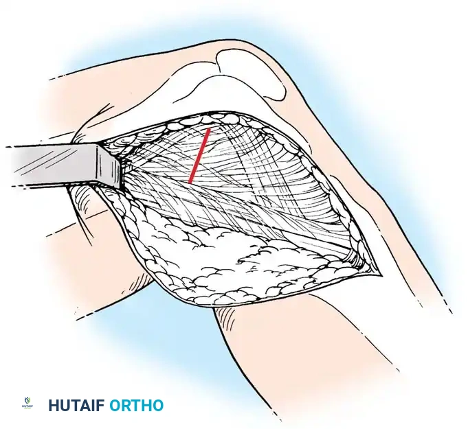 Hutaifortho's Orthopaedic Diagram