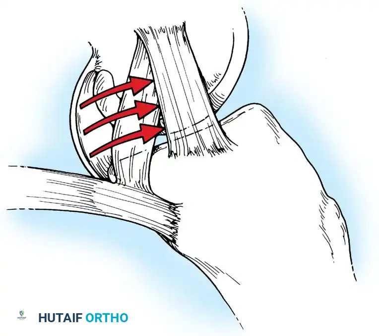 Hutaifortho's Orthopaedic Diagram