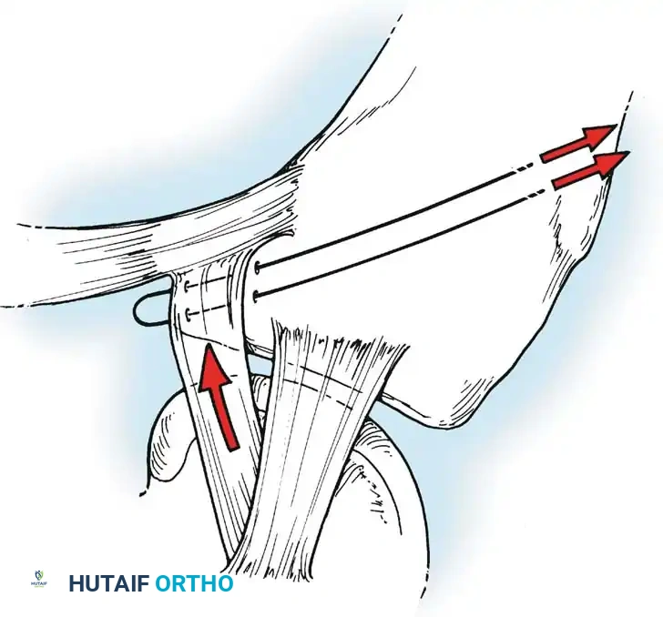 Hutaifortho's Orthopaedic Diagram