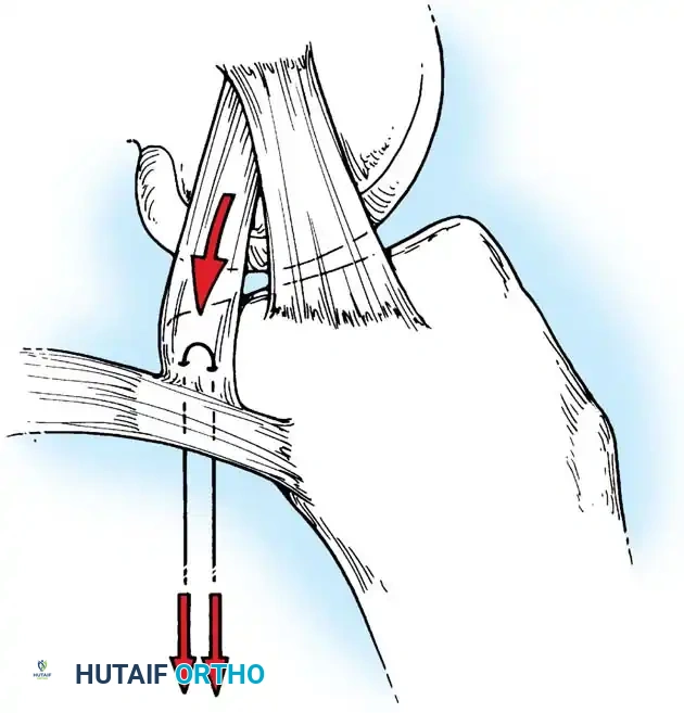 Hutaifortho's Orthopaedic Diagram