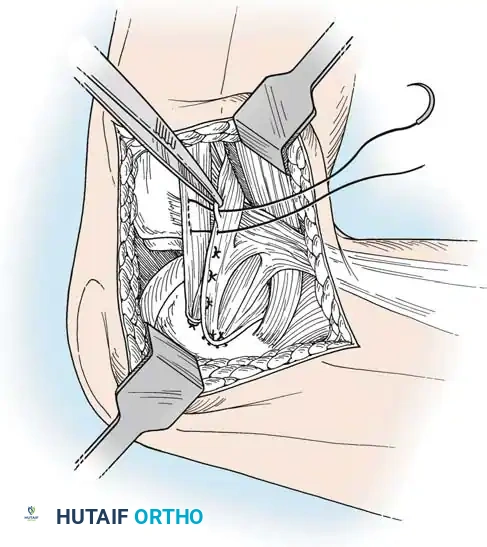 Hutaifortho's Orthopaedic Diagram