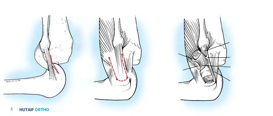 Hutaifortho's Orthopaedic Diagram