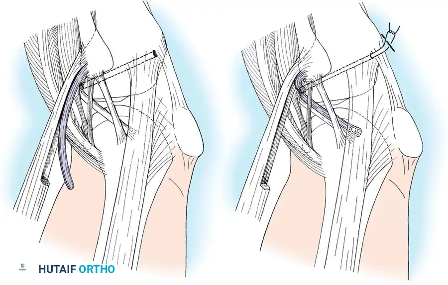Hutaifortho's Orthopaedic Diagram