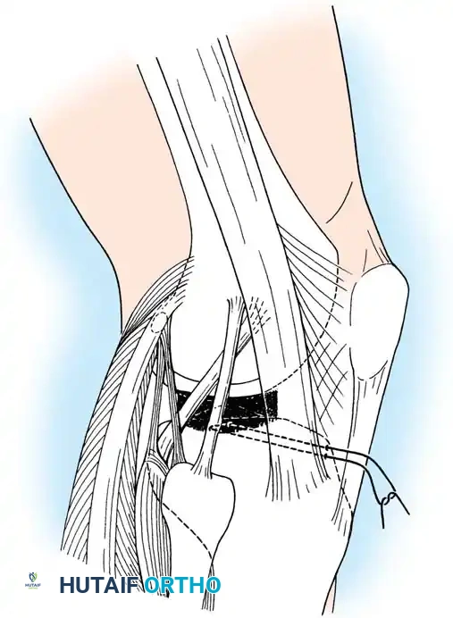 Hutaifortho's Orthopaedic Diagram