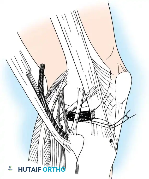 Hutaifortho's Orthopaedic Diagram