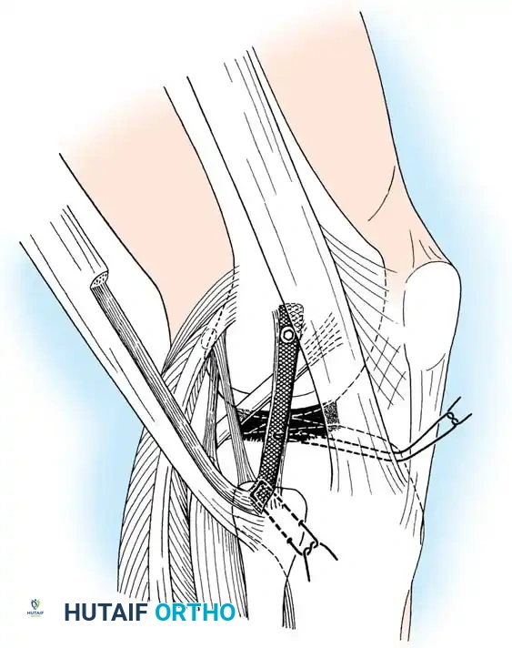Hutaifortho's Orthopaedic Diagram