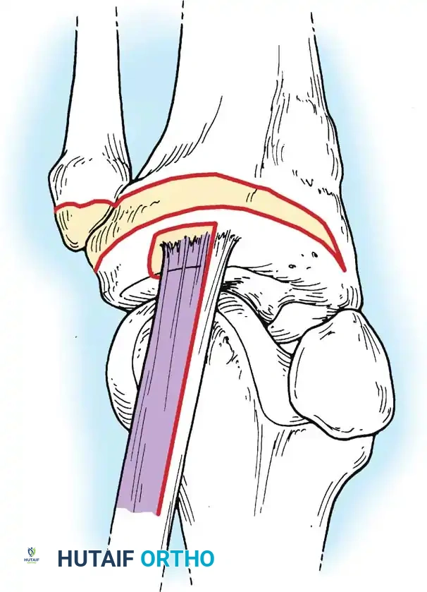 Hutaifortho's Orthopaedic Diagram
