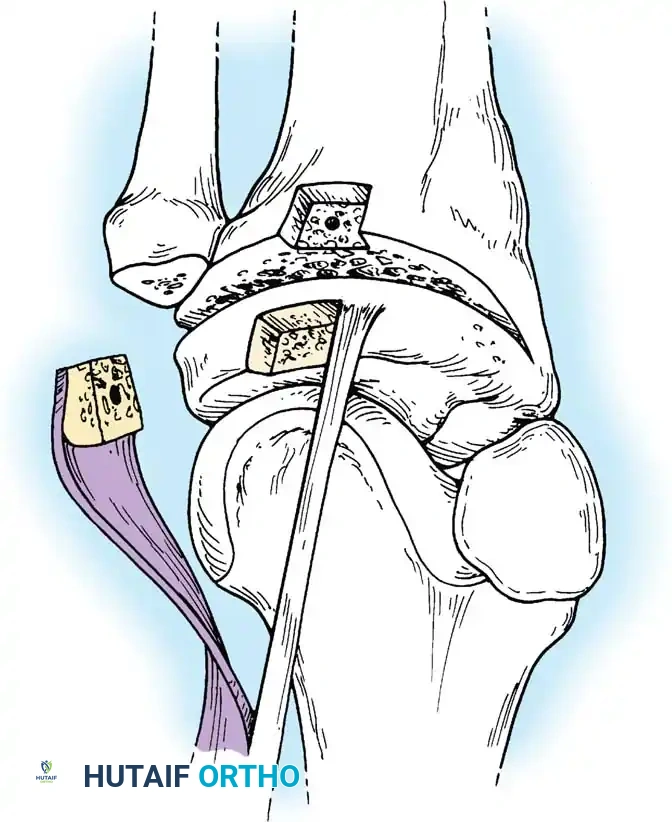 Hutaifortho's Orthopaedic Diagram