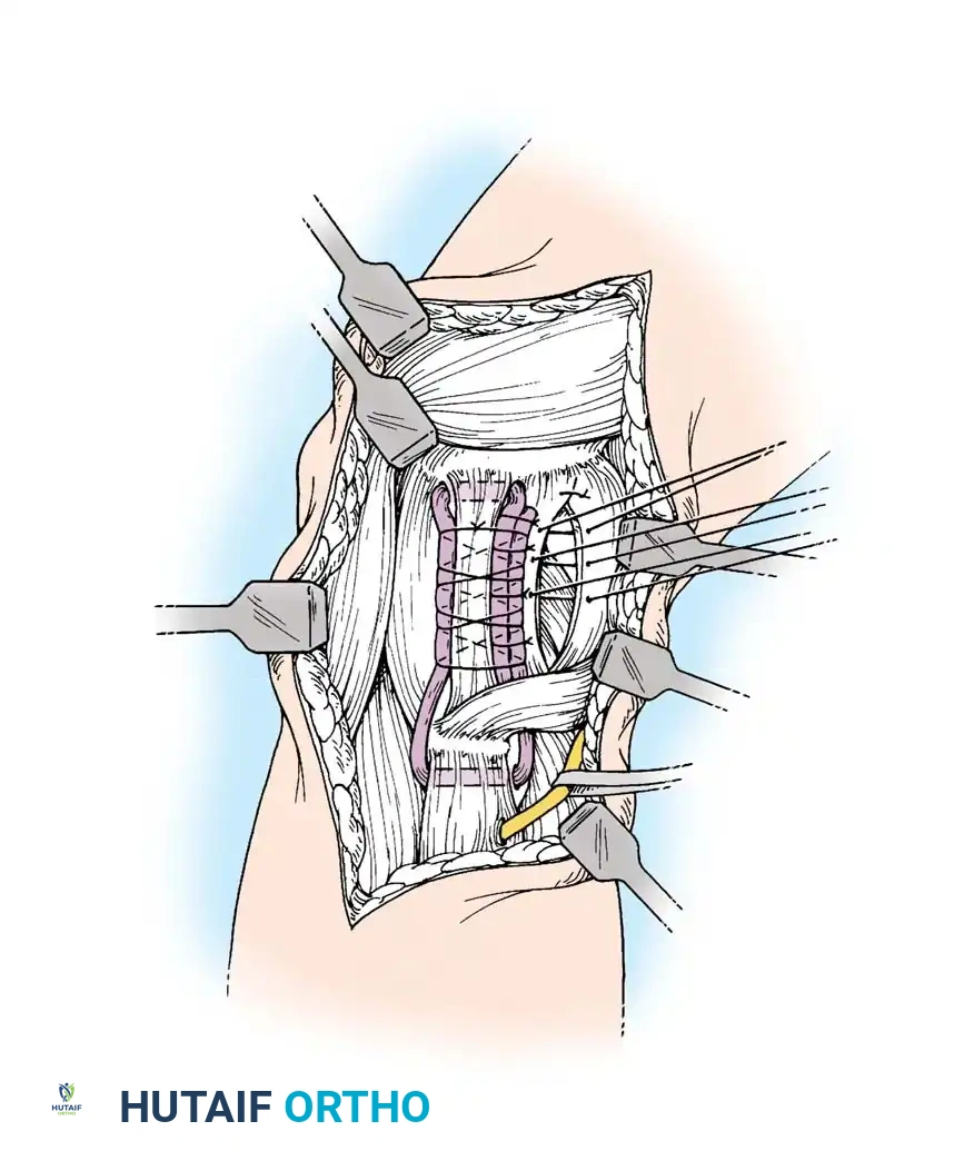 Hutaifortho's Orthopaedic Diagram