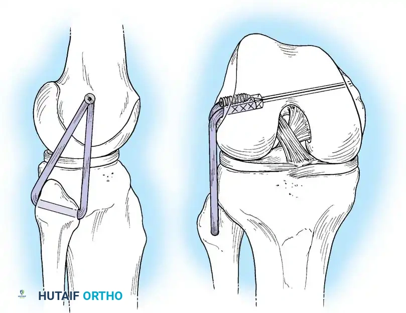 Hutaifortho's Orthopaedic Diagram