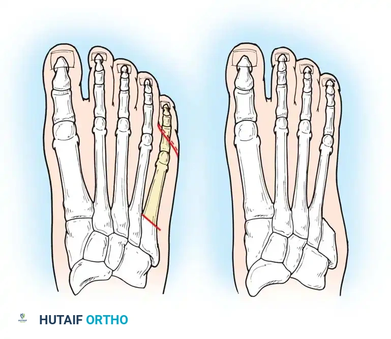 Hutaifortho's Orthopaedic Diagram