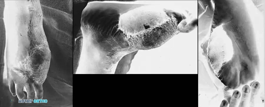 Hutaifortho's Orthopaedic Diagram