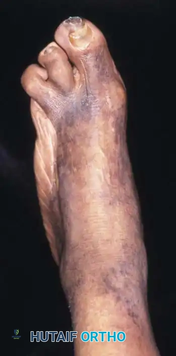 Hutaifortho's Orthopaedic Diagram