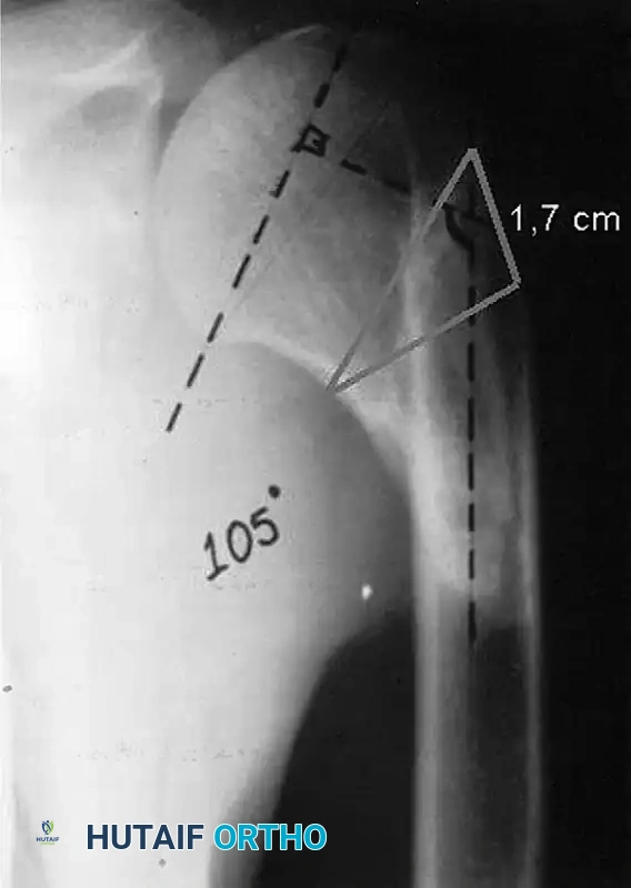 ANATOMICAL NECK Surgical Diagram