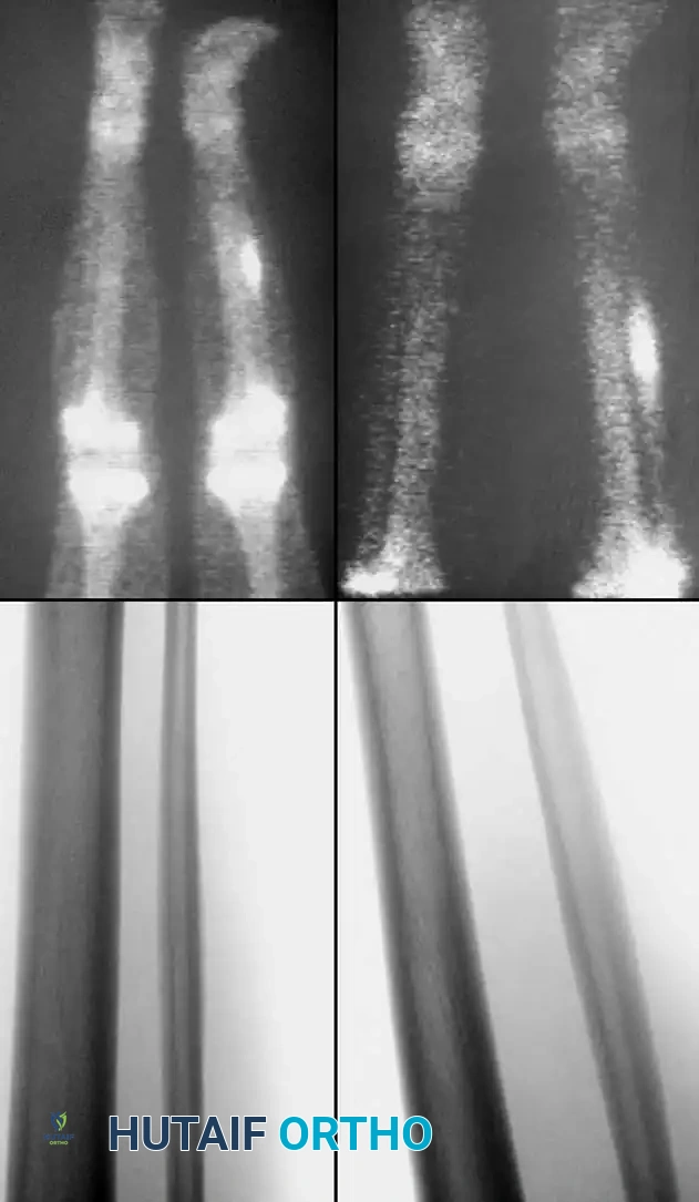 Hutaifortho's Orthopaedic Diagram