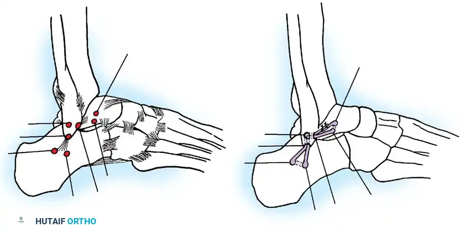 Hutaifortho's Orthopaedic Diagram