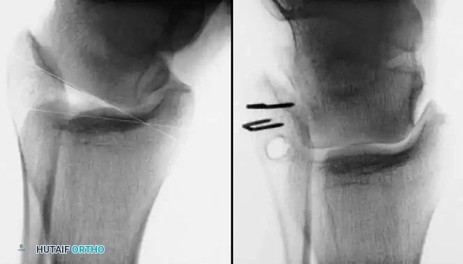 Hutaifortho's Orthopaedic Diagram