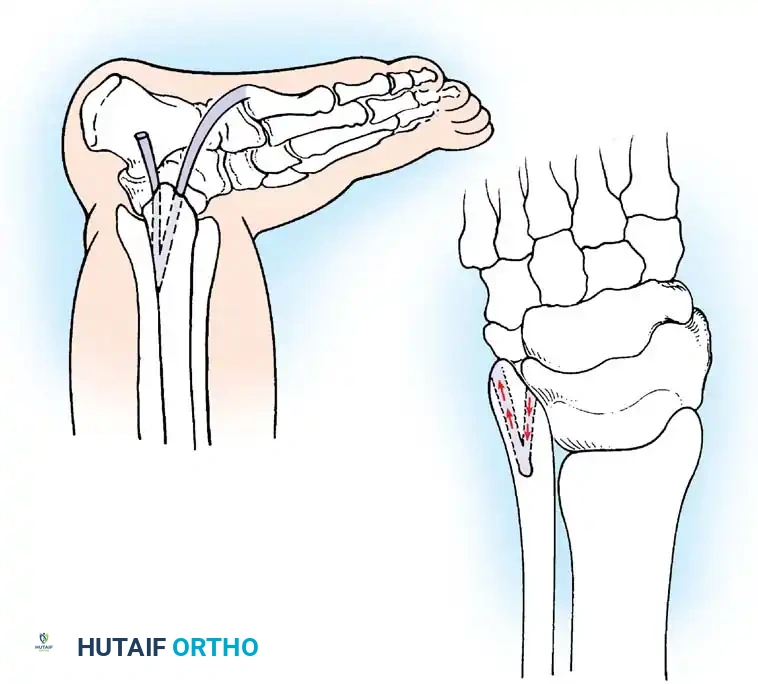 Hutaifortho's Orthopaedic Diagram