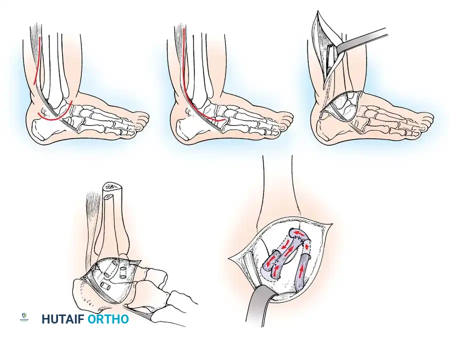 Hutaifortho's Orthopaedic Diagram