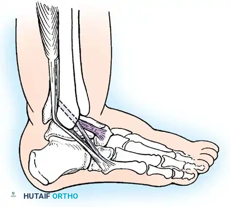 Hutaifortho's Orthopaedic Diagram