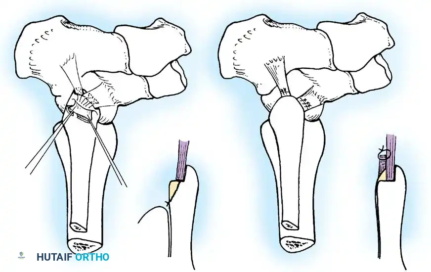 Hutaifortho's Orthopaedic Diagram